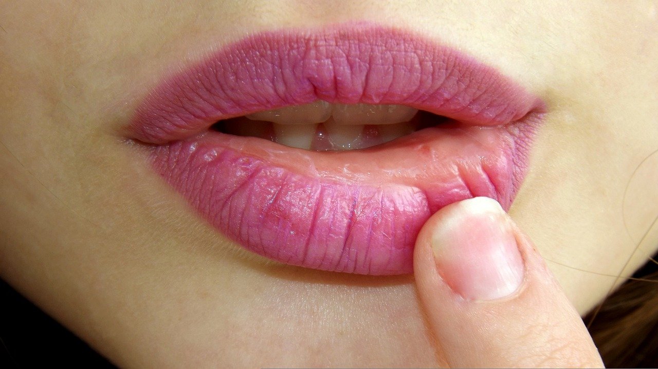 What Causes Herpes Flare Ups On Lips? 