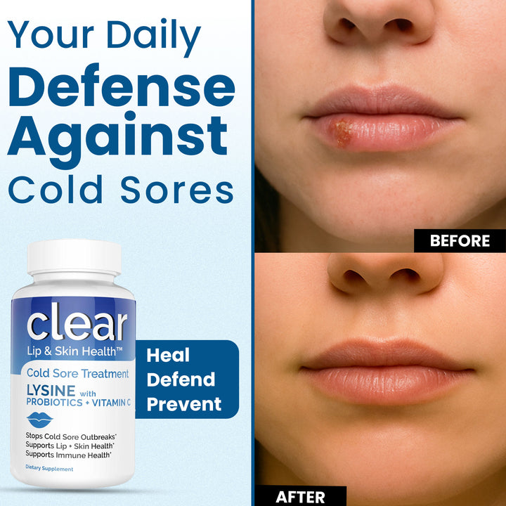 Clear Lip & Skin Health